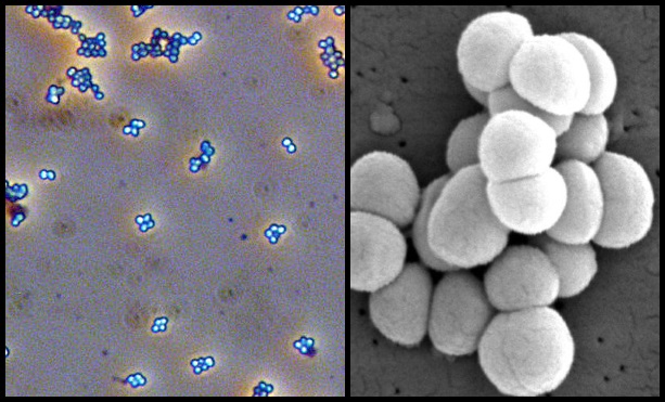 Micrococcus luteus Micrococcus_luteus