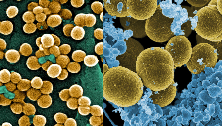 Staphylococcus aureus Staphylococcus_aureus