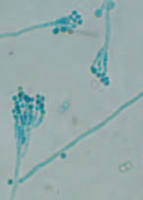 Penicillium chrysogenum Penicillium_chrysogenum