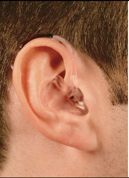 سماعات الأذن الطبية لضعف السمع  Behind-the-ear