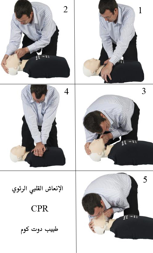 الإنعاش القلبي الرئوي بالمملكة العربية السعودية - الماضي والحاضر والمستقبل CPR