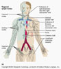  الجهاز المناعي - الجهاز الليمفاوي والغدة الدرقية  Lymphatic_Ducts_thumb