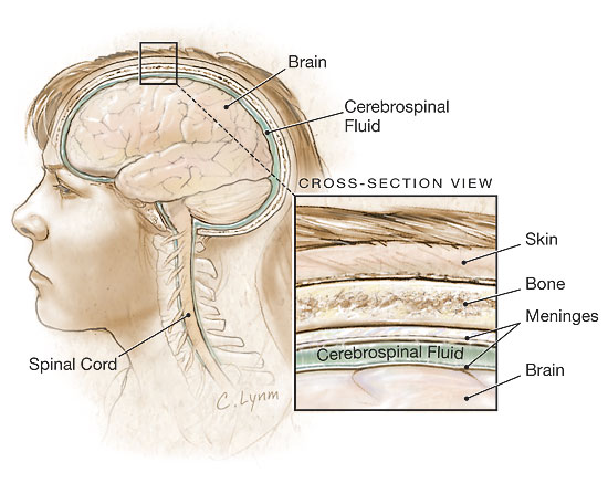 موسوعة أمراض المخ والأعصاب 1 Meningitis