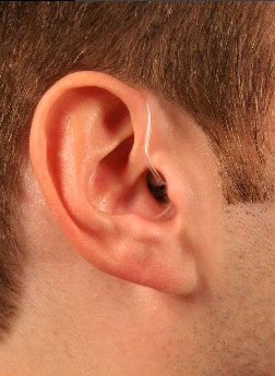 سماعات الأذن الطبية لضعف السمع  Open-fit-behind-the-ear