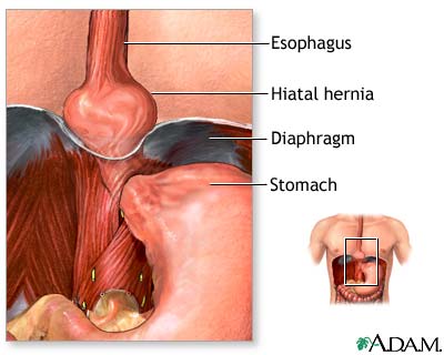 اضربات السائل الامنيوسى Esophagus%282%29