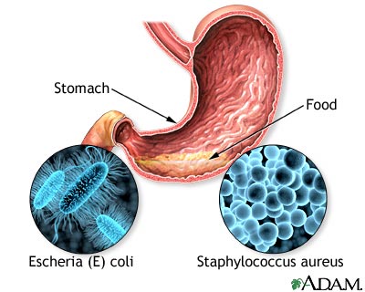 التسمم الغذائي  Food-poisoning