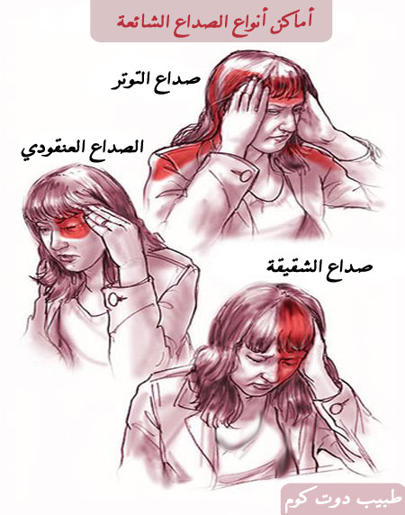 الصداع Headache Headache%281%29