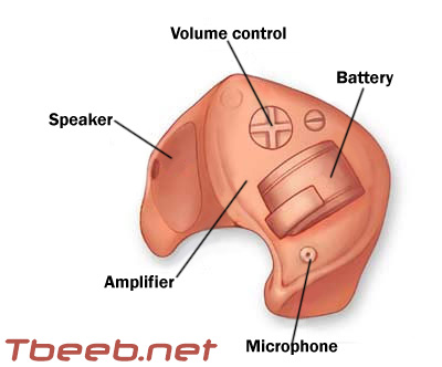 سماعات الأذن الطبية لضعف السمع  Hearingaid_parts