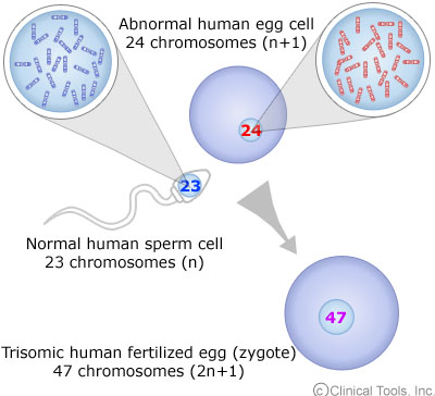 الحمل الصح والخطاء فى مخاوفك Sperm_egg_trisomy_fertilization