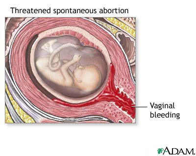 منبر البحوث المتخصصة والدراسات العلمية  يشاهده  23456 زائر Vaginal-bleeding