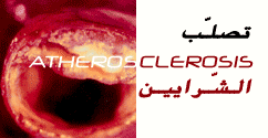 تصلب الشرايين 048f46c4a1