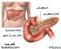 ‏البنكرياس ، المعثكلة Pancreas 15ad901e81