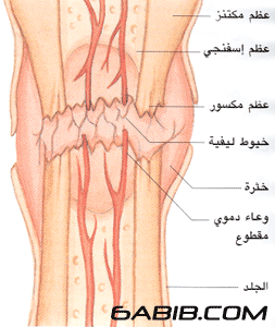 موسوعة طبية المصورة مع الشرح E3c152004f