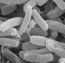 يربط الكثيرين البكتيريا بالمرض فقط NfE.coli2SEM