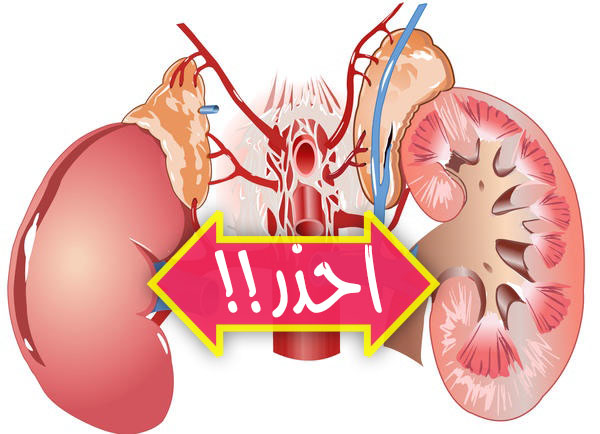 ١٠ عادات تدمر الكلى أحذر منها لتحافظ على صحة الكليتين Kidney-copy