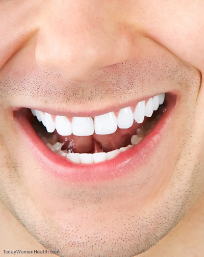 وصفات تبييض الاسنان والتخلص من اصفرارها Man-with-white-teeth