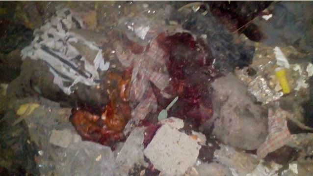 Scattered Body Parts Of Suicide Bombers After Attack In Borno (graphic Photos) Nem4