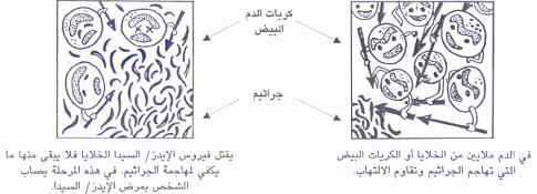 مرض الإيدز - السيدا - مرض ضعف جهاز المناعة 11262683353