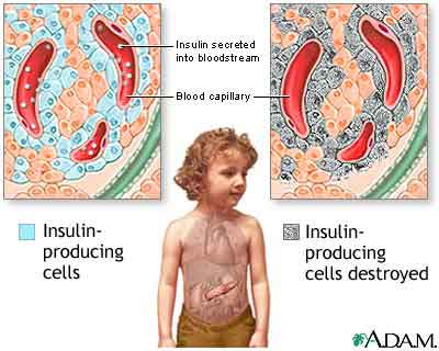 Symptoms of Diabetes in Urdu 941photo1