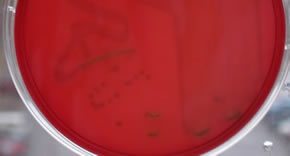 Summary of Biochemical Tests BAP-gamma