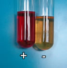 Summary of Biochemical Tests MR