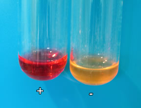 Summary of Biochemical Tests MR