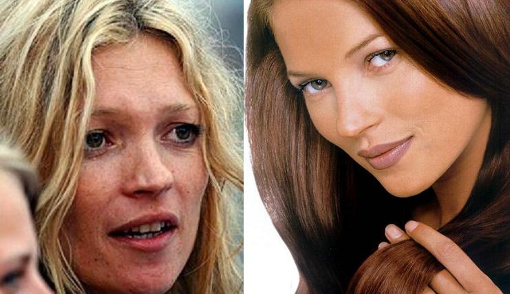 فنانات عالميات قبل عمليات التجميل Kate-moss