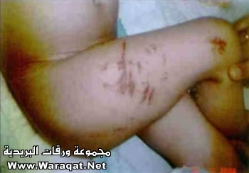 تعذيب طفله عمرها 5 سنوات بالصور T3zeeb_reem1