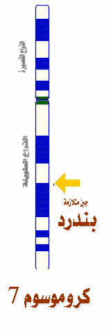  متلازمة بندرد Pendred syndrome Chromo_7