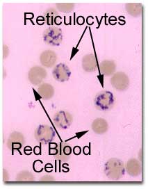 Reticulocytes Test: 19