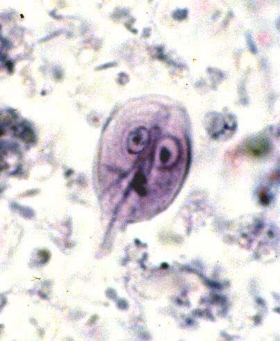 الجيارديا - Giardia 236