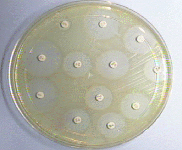 Antibiotic Susceptibility Test: 50