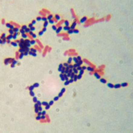 Gram stain procedure: 52