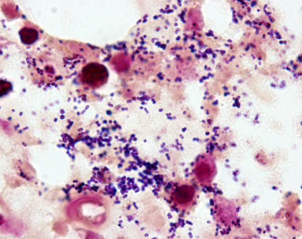 Gram stain procedure: 53