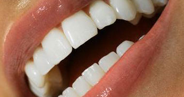 ما علاج تآكل اللثة وسقوط الأسنان؟  Smal2201018193714
