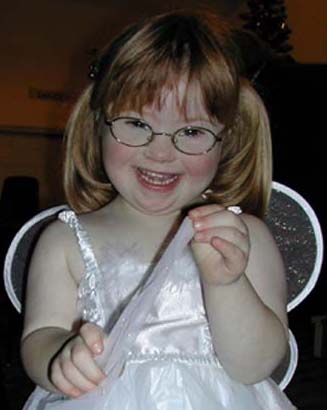  صور لاطفال متلازمة الداون ........... ملائكة السعادة  Aliceforwebsmaller
