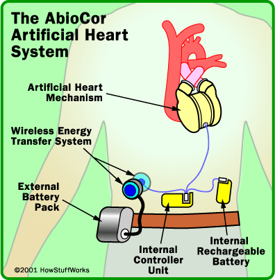 Artificial heart 853596263