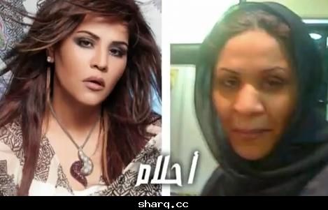 فنانات قبل و بعد عمليات التجميل  862278820