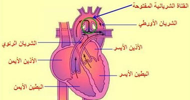 عضلة القلب مشاكلها والعلاج 231366810