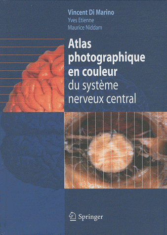  Atlas photographique en couleur du système nerveux central 820722959