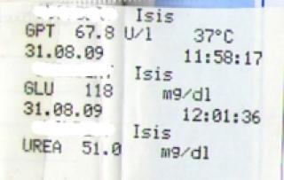 Conversion des taux d'urée et de créatinine 48379anaisisaout09