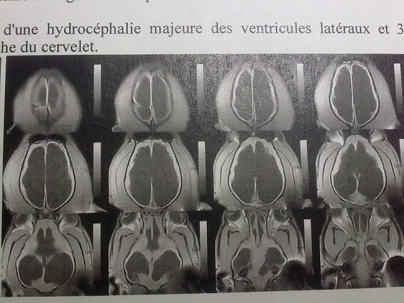 Hydrocéphalie majeure et encéphalopathie hypertensive  - Page 2 206105010120091328