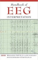 Handbook of Eeg Interpretation 1st Edition 8ljiiV