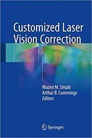 Customized Laser Vision Correction 8w5KXw