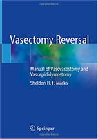 Vasectomy Reversal 9x2DMr