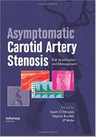 Asymptomatic Carotid Artery Stenosis DcLKPx