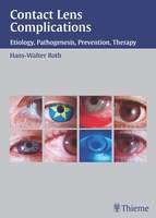 Contact Lens Complications 1st Edition EvbW8S