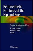 Periprosthetic Fractures of the Hip and Knee KBRbTX