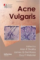 Acne Vulgaris 1st Edition Khcez6