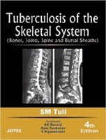 Tuberculosis of the Skeletal System 4th ed 0MSdUf